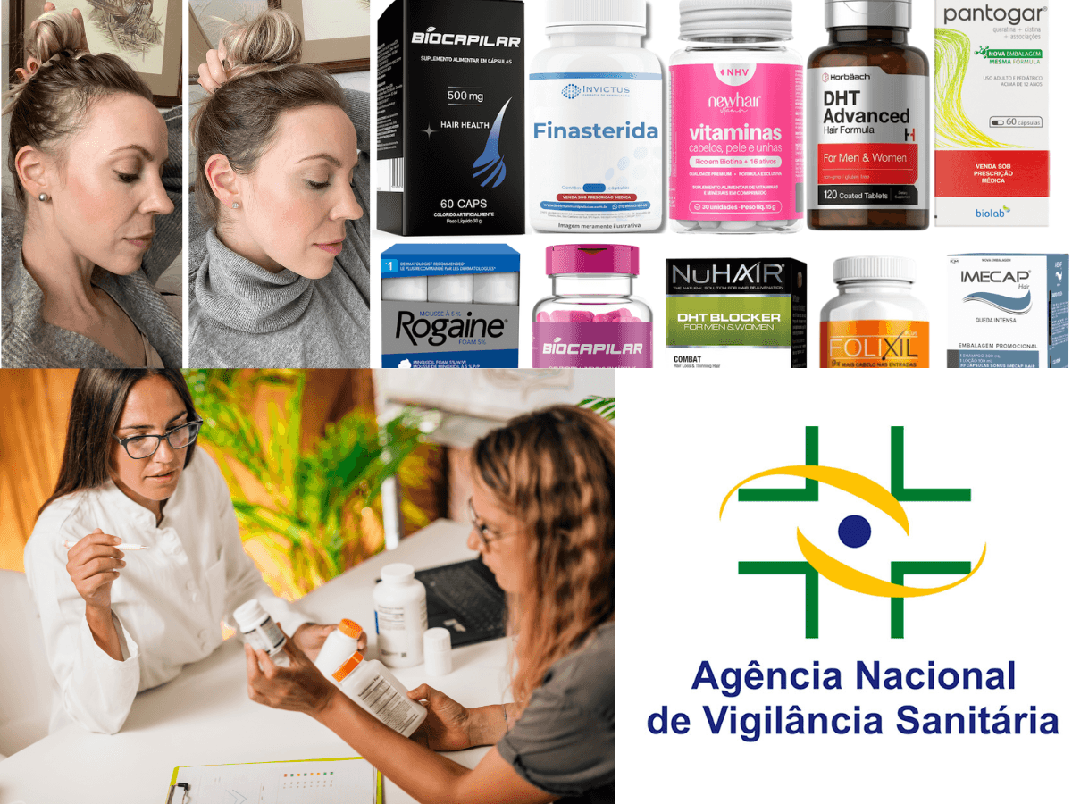 Produtos para queda de cabelo feminino